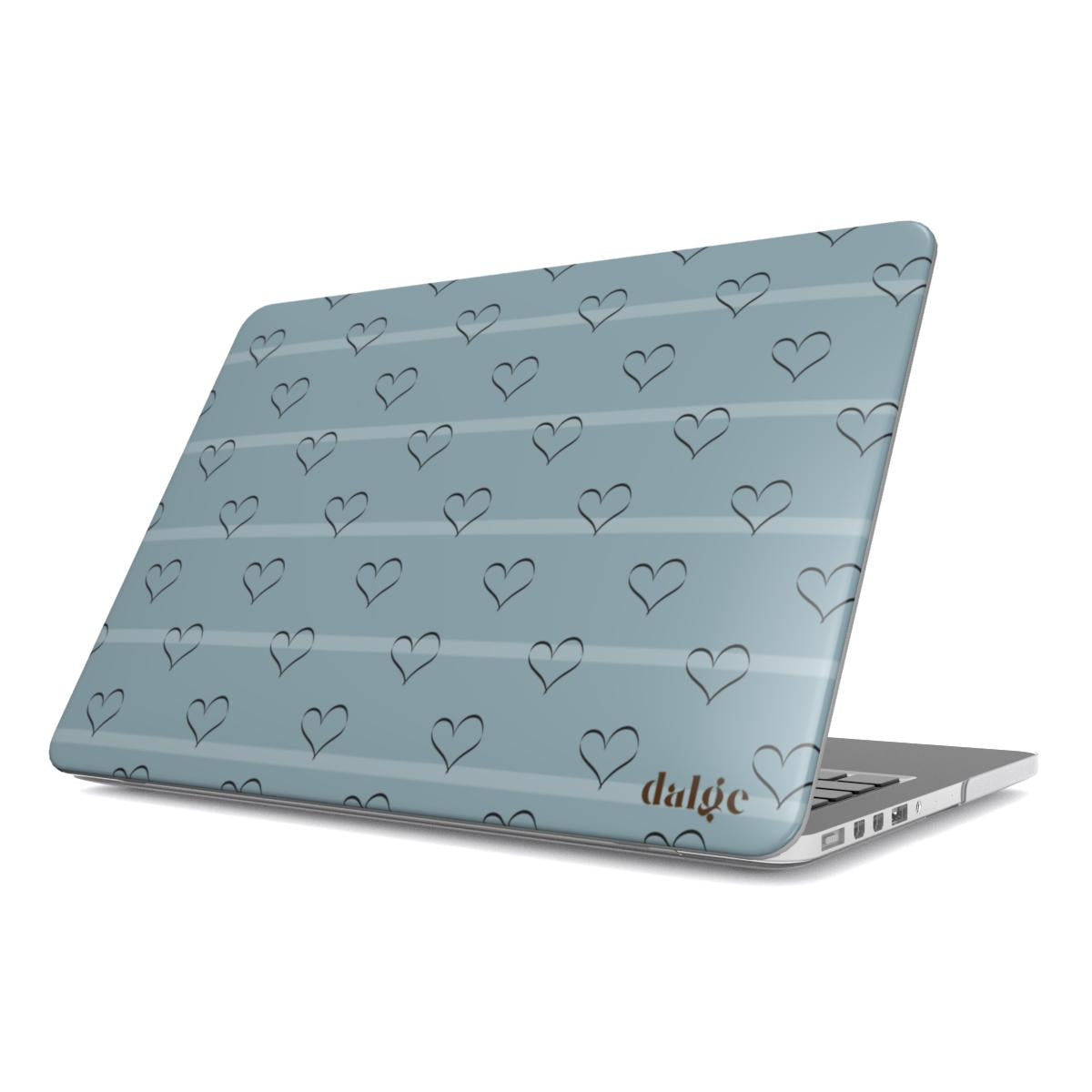 Date Her Laptop Case Int.