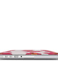 Spring Break Laptop Case | Floral designed MacBook Case from our Spring Edition Collection